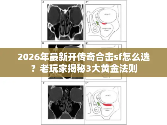 2026年最新开传奇合击sf怎么选？老玩家揭秘3大黄金法则